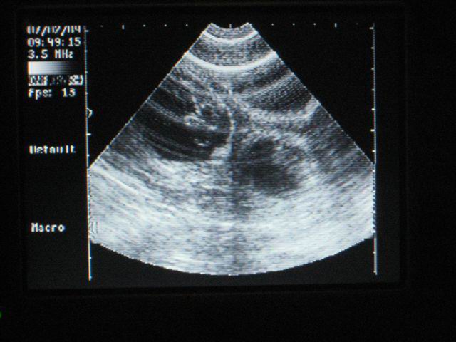 7 febr 2009, foto van de drachtigheidscan